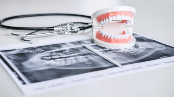 هيئة أطباء الأسنان تحذر من ممارسات عشوائية تهدد الصحة العامة وتدعو لتحرك حازم لحماية المواطنين وصورة المملكة