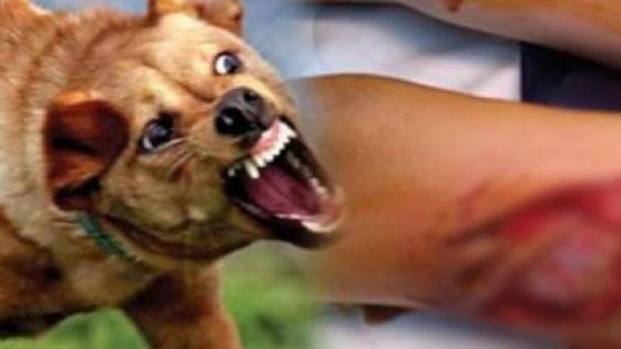 عضة كلب بالعرائش تكشف نقصًا مقلقًا في مصل داء الكلب