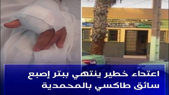 اهتزت مدينة المحمدية ونواحيها على وقع حادثة خطيرة تعرض لها سائق سيارة أجرة أثناء مزاولته لعمله،