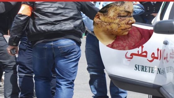 تازة .. توقيف شخص للاشتباه في اختطاف طليقته والاعتداء عليها بآلة حادة